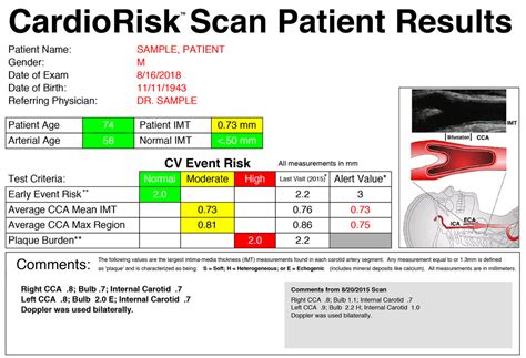 carotid intima media thickness measurement|cimt thickness chart.